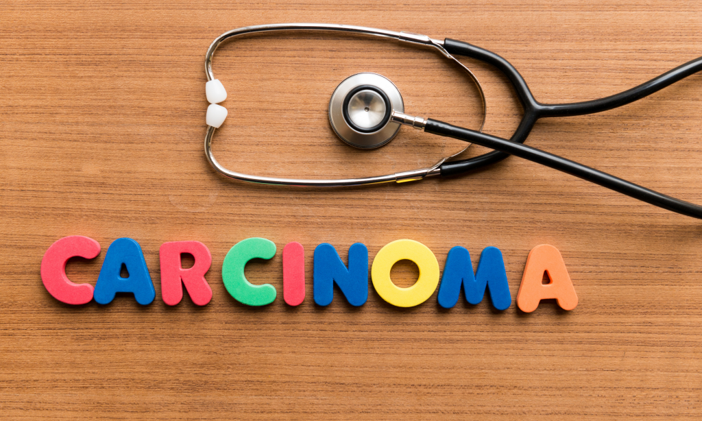 Carcinoma colorful word with Stethoscope on wooden background