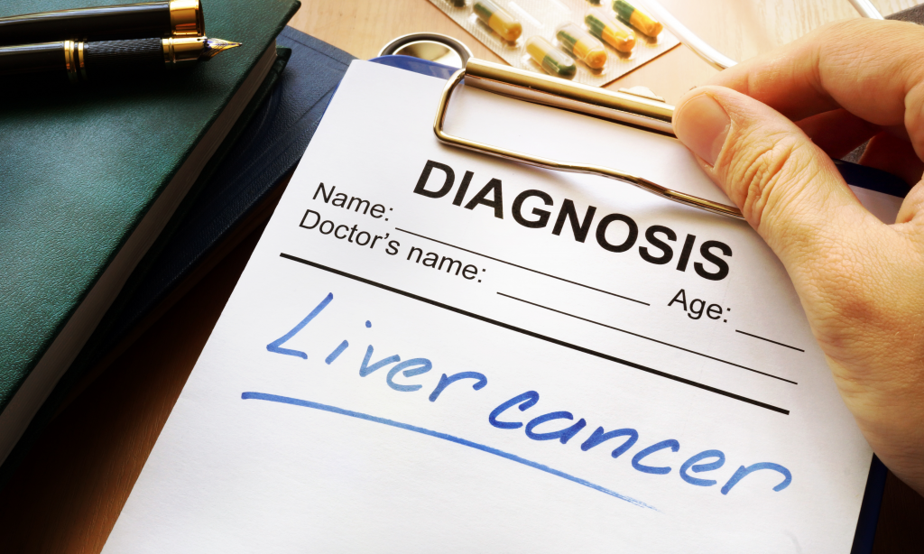 liver cancer diagnosis on a medical form