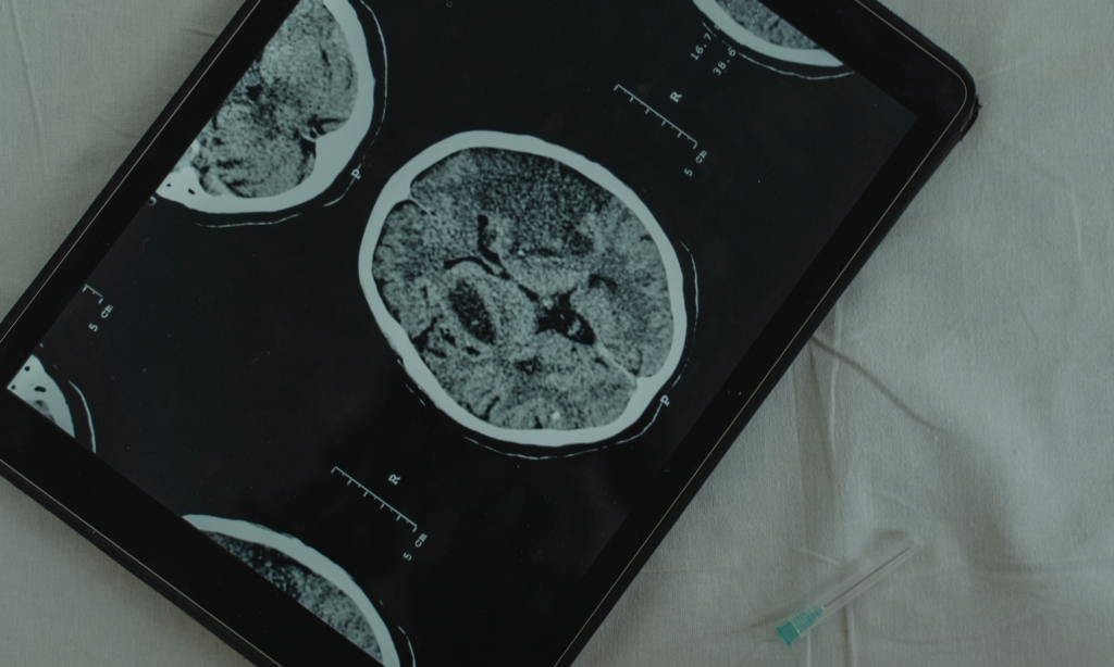 image of a brain on an electronic tablet