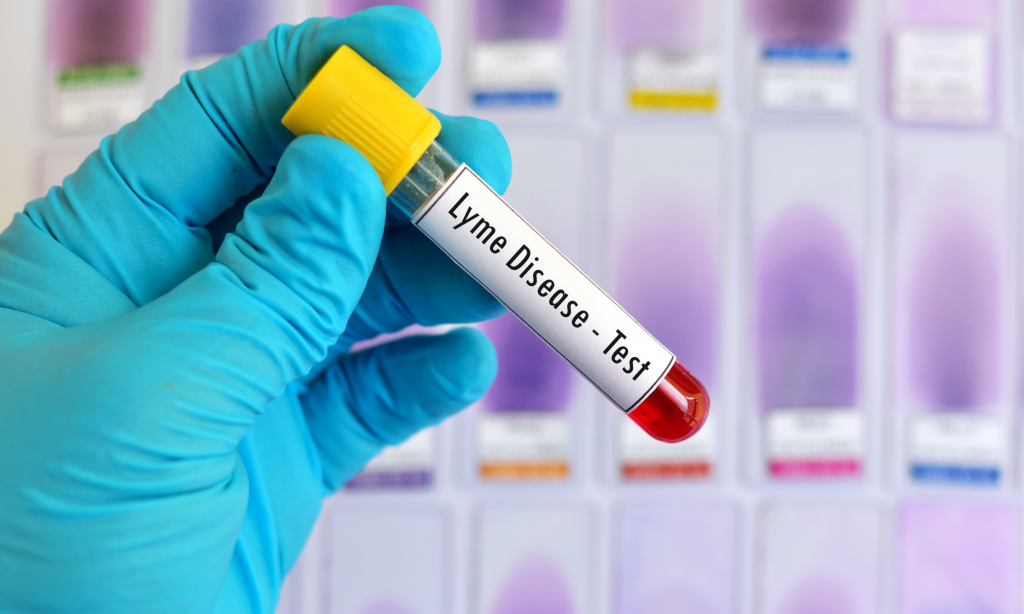 blood sample for lyme disease test