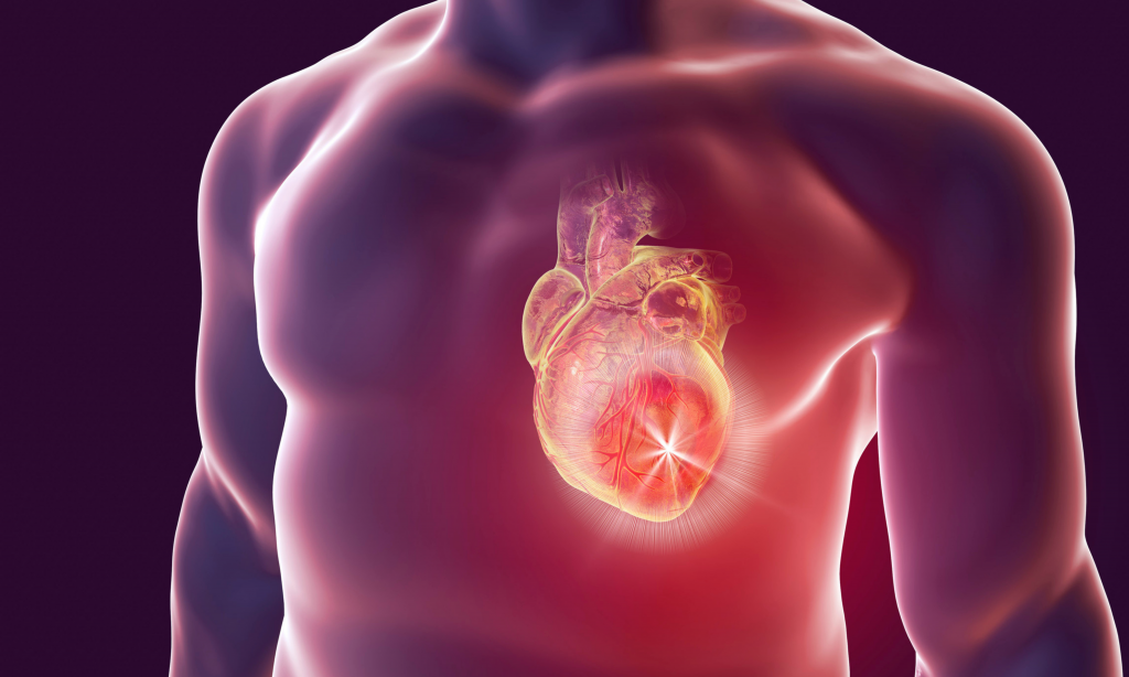 heart disease conceptual computer illustration