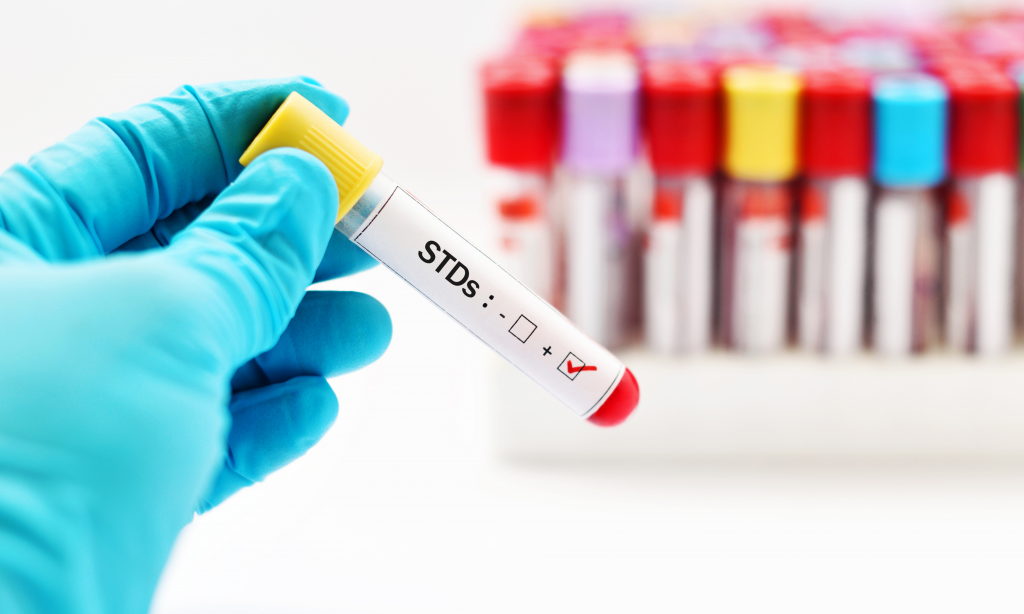 blood sample positive with STD test