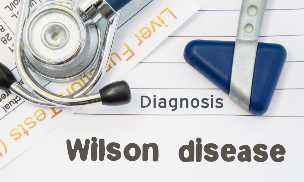 Diagnosis Wilson Disease. Neurological hammer, stethoscope and liver laboratory test lie on note with title of Wilson Disease. Concept for neurology and gastroenterology