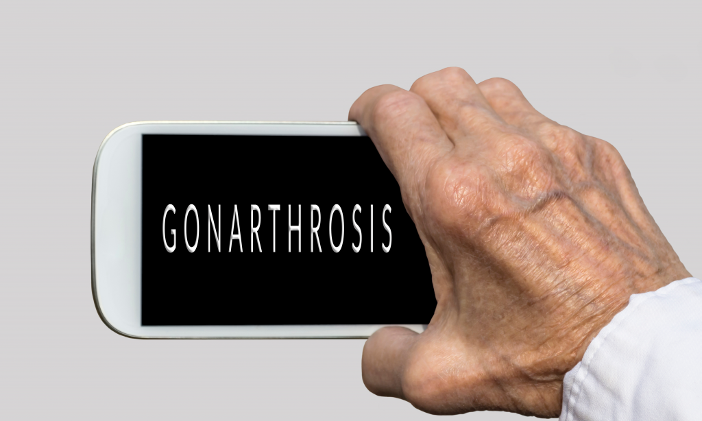 Smart phone in old hand with GONARTHROSIS text
