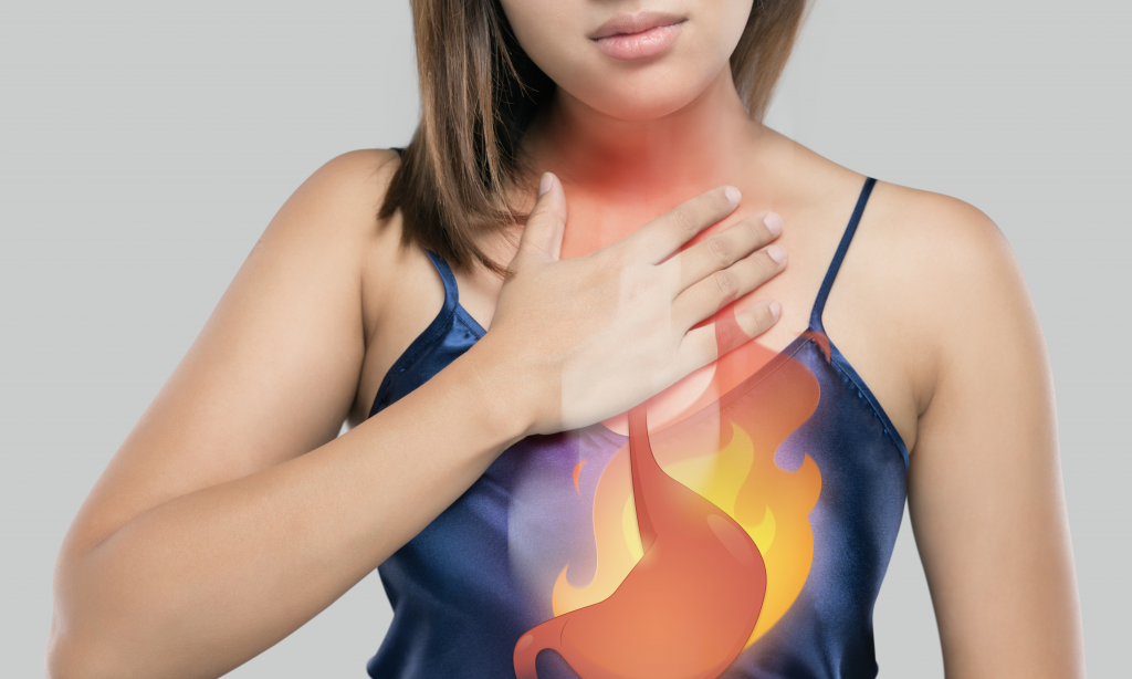 The Photo Of Cartoon Stomach On Woman's Body Against White Background, Acid Reflux Disease Symptoms Or Heartburn