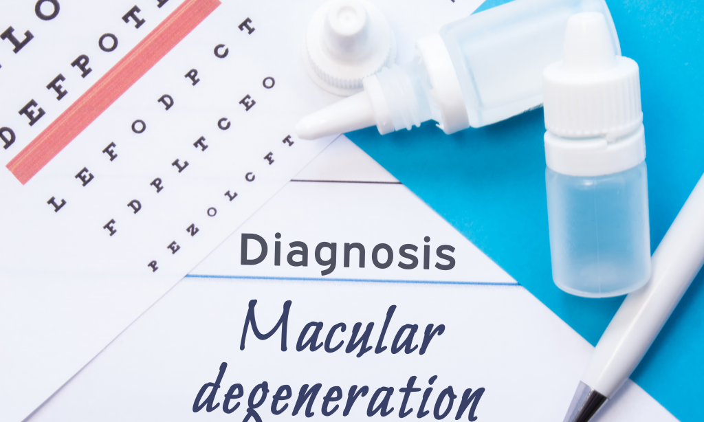 Ophthalmology diagnosis Macular Degeneration. Snellen (eye) chart, two bottles of eye drops (medications) lying on note with inscription Macular Degeneration diagnosis in ophthalmologist office
