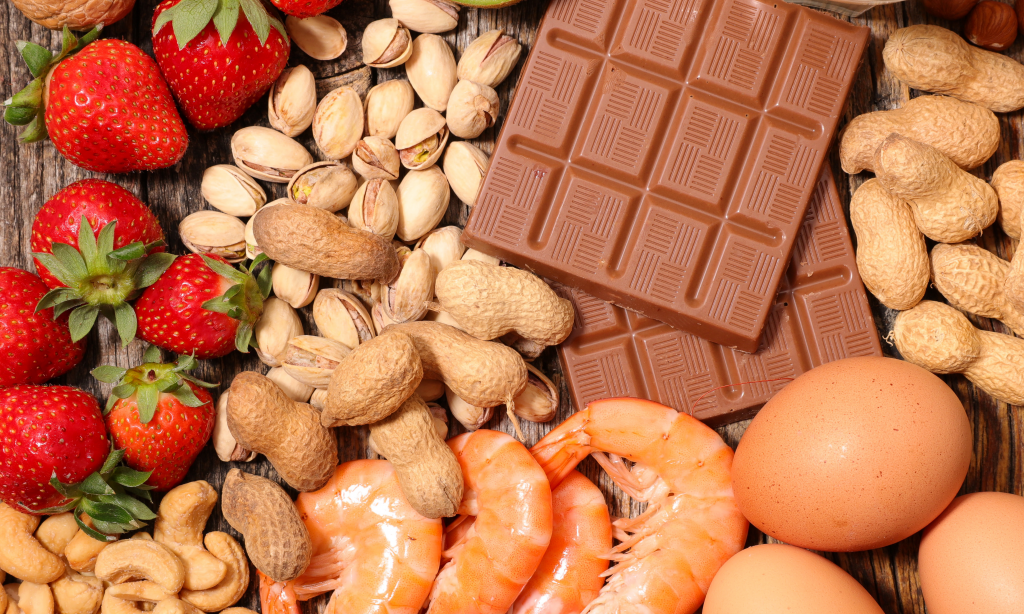 food flatlay, chocolate, strawberries, eggs, shellfish and an assortment of nuts