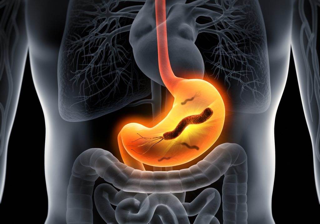 3D illustration of a helicobacter pylori bacteria in the stomach
