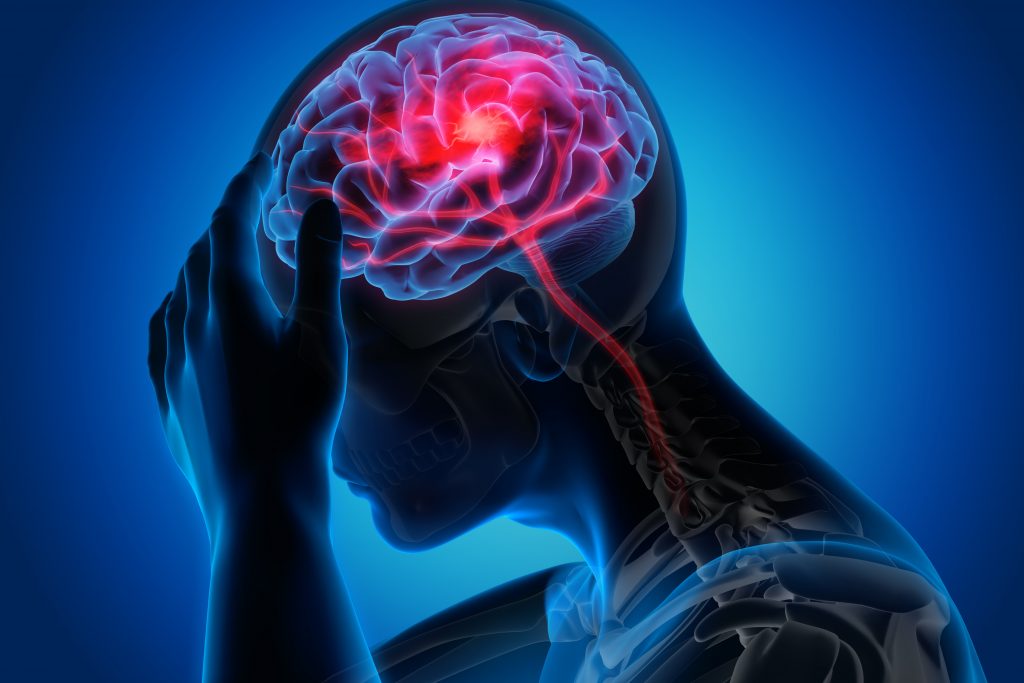 digital illustraion of a person with brain highlighted and a red flare where the problem would be